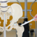 Symbolbild Osteoporose mit möglicher Bruchstelle der Hüfte. Foto: LKHB